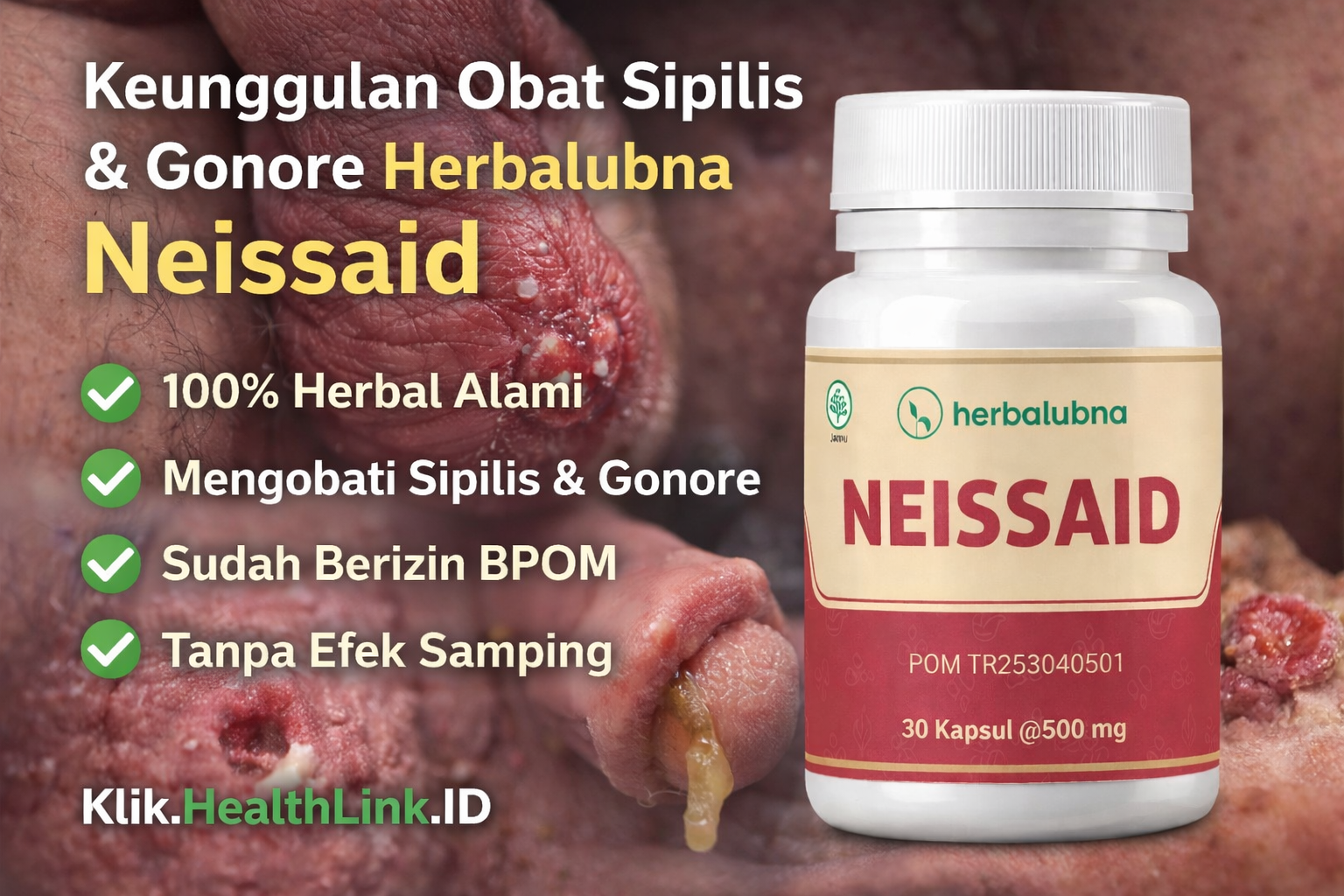 Herbalubna Neissaid obat herbal tradisional Indonesia yang mendukung terapi obat sifilis dan gonore serta membantu masalah kencing nanah dan kencing darah
